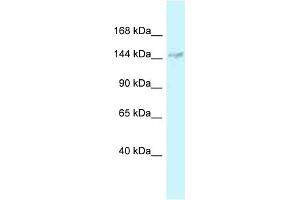 WB Suggested Anti-DHX38 Antibody Titration: 1. (DHX38 Antikörper  (Middle Region))