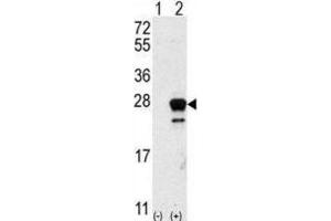 Western Blotting (WB) image for anti-GTPase NRas (NRAS) antibody (ABIN5023677) (GTPase NRas Antikörper)