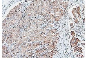 IHC analysis of COMT using anti-COMT antibody (ABIN7601948). (COMT Antikörper  (AA 52-271))