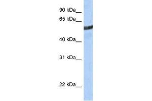 ME3 antibody used at 1 ug/ml to detect target protein.