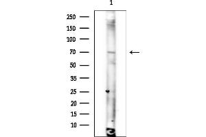 Western blot analysis of lysates from COLO205 cells(heat-shock treatment), using Phospholipase  activator protein Antibody at 1/1000 dilution.