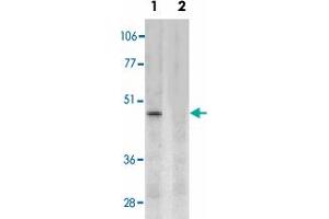 Western blot analysis of CD209 expression in human placenta tissue lysate in the absence (lane 1) and presence (lane 2) of blocking peptide with CD209 polyclonal antibody  at 2 ug /mL .