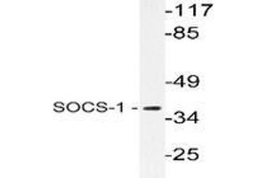 Western blot analysis of SOCS-1 in extracts from Jurkat cells using SOCS1 / JAB antibody . (SOCS1 Antikörper)