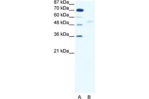 Western Blotting (WB) image for anti-SMAD, Mothers Against DPP Homolog 5 (SMAD5) antibody (ABIN2460352) (SMAD5 Antikörper)