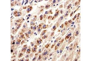 IHC analysis of FFPE human liver section using DHFR antibody; Ab was diluted at 1:25. (Dihydrofolate Reductase Antikörper  (AA 1-50))