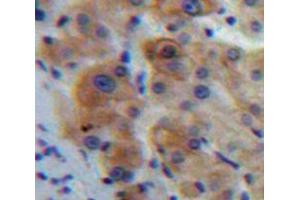 IHC-P analysis of Liver tissue, with DAB staining. (IL1R1 Antikörper  (AA 20-338))