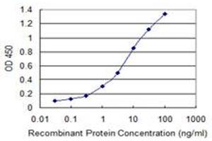 Detection limit for recombinant GST tagged LRRK1 is 0. (LRRK1 Antikörper  (AA 560-659))