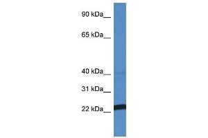Western Blot showing EFNA4 antibody used at a concentration of 1 ug/ml against MCF7 Cell Lysate (EFNA4 Antikörper  (N-Term))