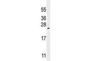 Western Blotting (WB) image for anti-Vascular Endothelial Growth Factor A (VEGFA) (AA 140-168) antibody (ABIN3029575)