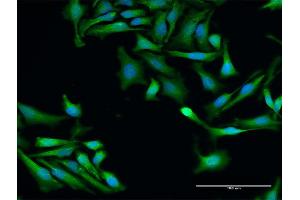 Immunofluorescence of purified MaxPab antibody to SRP19 on HeLa cell. (SRP19 Antikörper  (AA 1-144))