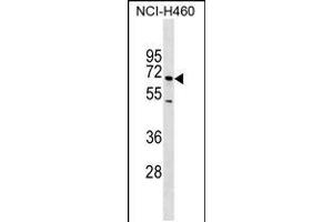 Western blot analysis in NCI-H460 cell line lysates (35ug/lane). (Selectin E/CD62e Antikörper)