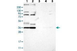 Western blot analysis of Lane 1: RT-4, Lane 2: U-251 MG, Lane 3: Human Plasma, Lane 4: Liver, Lane 5: Tonsil with YIPF2 polyclonal antibody  at 1:250-1:500 dilution. (YIPF2 Antikörper)