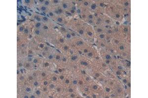 IHC-P analysis of liver tissue, with DAB staining. (GTF2H5 Antikörper  (AA 1-71))