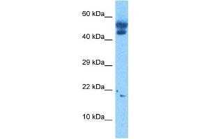 Western Blotting (WB) image for anti-Transcription Factor 21 (TCF21) (N-Term) antibody (ABIN2777930)