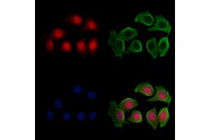 ABIN6263418 and ABIN6276466 staining Hela cells by IF/ICC.
