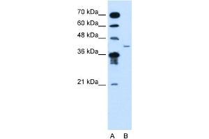 WB Suggested Anti-MFAP3L Antibody Titration:  2. (MFAP3L Antikörper  (N-Term))