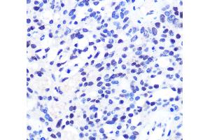 Immunohistochemistry (Paraffin-embedded Sections) (IHC (p)) image for anti-Chromodomain Helicase DNA Binding Protein 4 (CHD4) antibody (ABIN7255670)