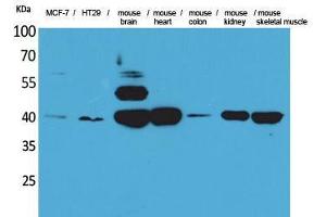 Western Blotting (WB) image for anti-Isocitrate Dehydrogenase 3 (NAD+) alpha (IDH3A) (Internal Region) antibody (ABIN3178348) (IDH3A Antikörper  (Internal Region))