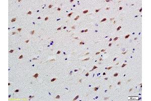 Formalin-fixed and paraffin embedded rat brain labeled with Anti-TUBB3 Polyclonal Antibody, Unconjugated  at 1:200 followed by conjugation to the secondary antibody and DAB staining (TUBB3 Antikörper  (AA 401-450))