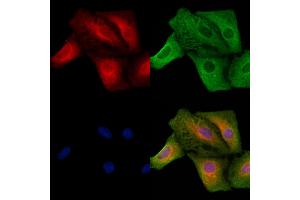 ABIN6257242 and ABIN6273630 staining  cells by IF/ICC. (GRIP1 Antikörper  (Internal Region))