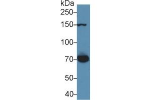 Detection of THBS1 in Rat Serum using Polyclonal Antibody to Thrombospondin 1 (THBS1) (Thrombospondin 1 Antikörper  (AA 71-259))