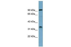 SDS antibody used at 1 ug/ml to detect target protein. (serine Dehydratase Antikörper  (Middle Region))