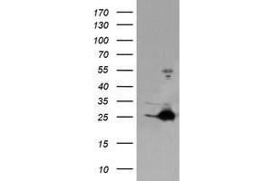 Image no. 1 for anti-Fetal and Adult Testis Expressed 1 (FATE1) antibody (ABIN1498221) (FATE1 Antikörper)