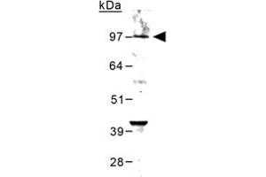 Western blot analysis of Grm6 in mouse brain lysate using Grm6 polyclonal antibody  at 0. (Metabotropic Glutamate Receptor 6 Antikörper)