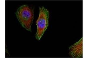 Image no. 1 for anti-Mitogen-Activated Protein Kinase 1/3 (MAPK1/3) (pThr185), (pTyr202) antibody (ABIN196998) (ERK1/2 Antikörper  (pThr185, pTyr202))