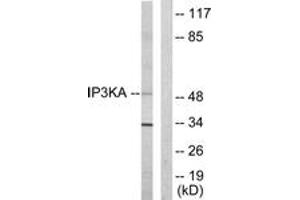 Western blot analysis of extracts from HuvEc cells, using IP3KA Antibody. (ITPKA Antikörper  (AA 396-445))
