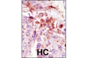 Immunohistochemistry (Paraffin-embedded Sections) (IHC (p)) image for anti-Interleukin-1 Receptor-Associated Kinase 1 (IRAK1) (AA 683-712), (C-Term) antibody (ABIN392233)