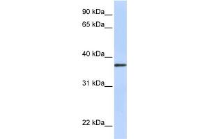 WB Suggested Anti-TTMB Antibody Titration:  0. (TMEM200B Antikörper  (N-Term))