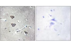 Immunohistochemistry analysis of paraffin-embedded human brain tissue, using 5-HT-2C Antibody. (HTR2C Antikörper  (AA 161-210))