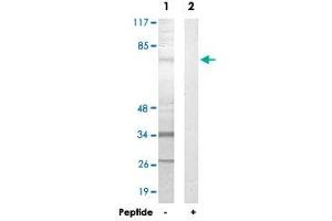 Western blot analysis of extracts from HepG2 cells, using FASTKD3 polyclonal antibody .