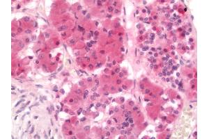 Human Pituitary: Formalin-Fixed, Paraffin-Embedded (FFPE) (FSHR Antikörper  (N-Term))