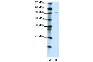 WB Suggested Anti-ZNF286  Antibody Titration: 1. (ZNF286A Antikörper  (C-Term))