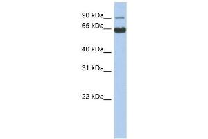 CCDC128 antibody used at 1 ug/ml to detect target protein. (KLRAQ1 Antikörper  (N-Term))