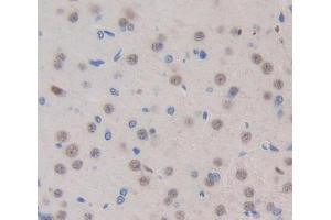 Used in DAB staining on fromalin fixed paraffin- embedded brain tissue (Exonuclease 1 Antikörper  (AA 1-250))