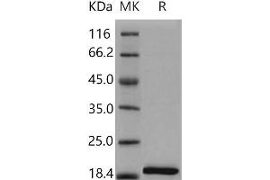 Western Blotting (WB) image for Interleukin 1, beta (IL1B) (Active) protein (ABIN7320465) (IL-1 beta Protein)
