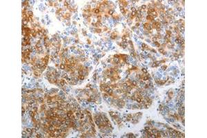 Immunohistochemical analysis of paraffin-embedded Human tonsil cancer tissue using at dilution 1/40. (CHD5 Antikörper  (C-Term))