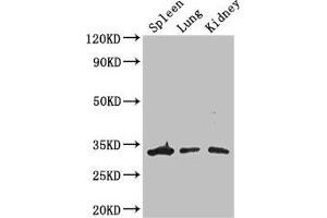 Western Blot Positive WB detected in: Mouse spleen tissue, Mouse lung tissue, Mouse kidney tissue All lanes: ALKBH4 antibody at 3 μg/mL Secondary Goat polyclonal to rabbit IgG at 1/50000 dilution Predicted band size: 34, 5 kDa Observed band size: 34 kDa (ALKBH4 Antikörper  (AA 1-115))