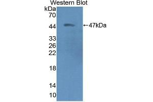 Western blot analysis of the recombinant protein. (CKMT2 Antikörper  (AA 40-419))