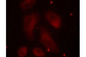 Immunofluorescence staining of methanol-fixed Hela cells using LIMK1(Phospho-Thr508) Antibody. (LIM Domain Kinase 1 Antikörper  (pThr508))