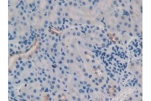 Immunohistochemistry (IHC) image for anti-Tumor Necrosis Factor (Ligand) Superfamily, Member 9 (TNFSF9) (AA 105-309) antibody (ABIN7443173)