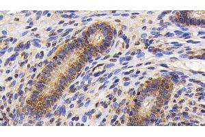 Detection of Surv in Human Uterus Tissue using Monoclonal Antibody to Survivin (Surv) (Survivin Antikörper  (AA 1-142))