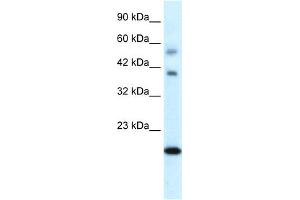 WB Suggested Anti-CGI-143 Antibody Titration:  0. (BOLA1 Antikörper  (N-Term))