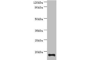 Western blot All lanes: TNNC2 antibody at 10 μg/mL + Mouse skeletal muscle tissue Secondary Goat polyclonal to rabbit IgG at 1/10000 dilution Predicted band size: 18 kDa Observed band size: 18 kDa (TNNC2 Antikörper  (AA 1-160))