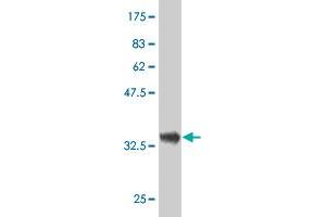 Western Blot detection against Immunogen (37. (DCMP Deaminase (DCTD) (AA 69-178) Antikörper)