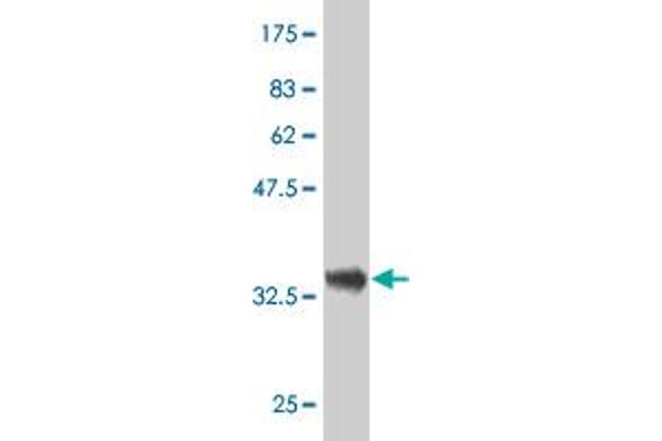 DCMP Deaminase (DCTD) (AA 69-178) Antikörper