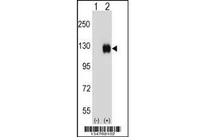 Western blot analysis of Ephb4 using rabbit polyclonal Mouse Ephb4 Antibody using 293 cell lysates (2 ug/lane) either nontransfected (Lane 1) or transiently transfected (Lane 2) with the Ephb4 gene. (EPH Receptor B4 Antikörper  (AA 360-389))